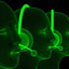 Decoding Speech